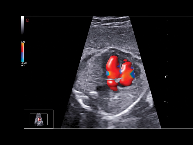 MyLab™A70 - BrightFlow