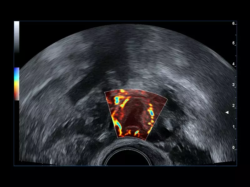 MyLab™Omega eXP - Women's Health 01