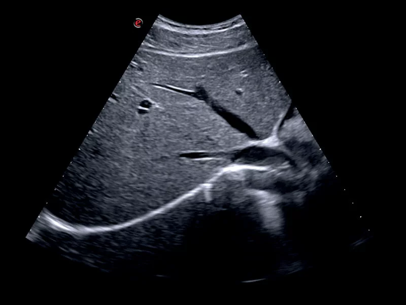 MyLab™X75 - General Imaging 01