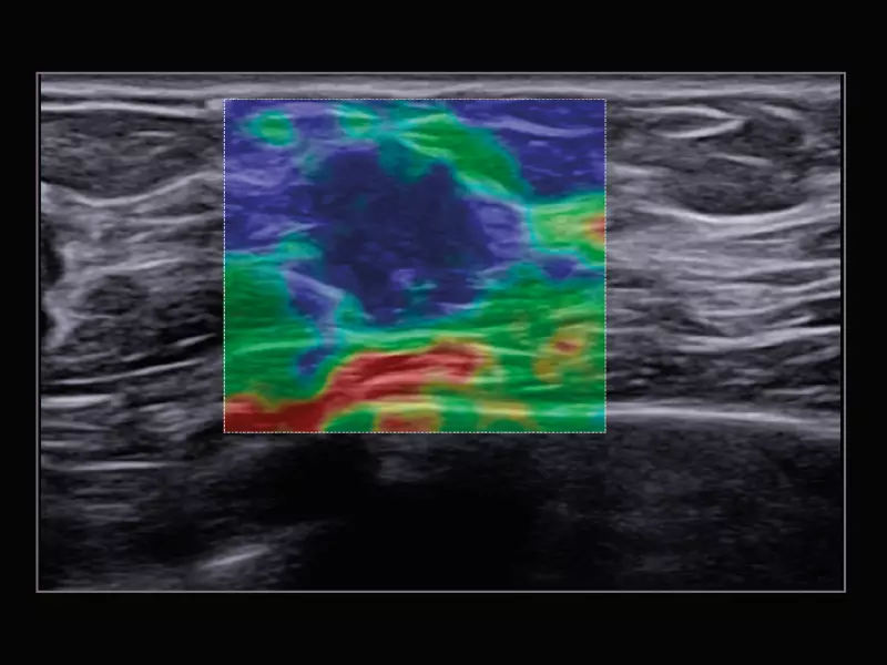 MyLab™X9 - General Imaging 06