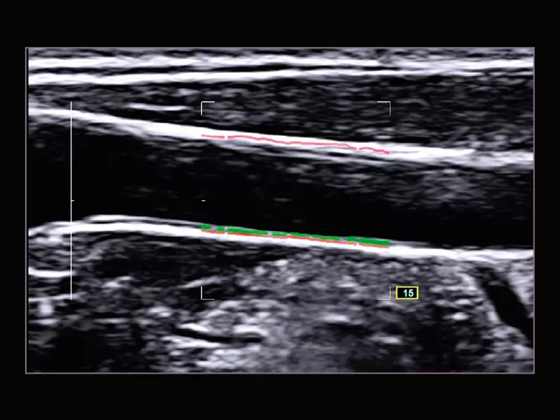 MyLab™X9 - Shared Service 10	