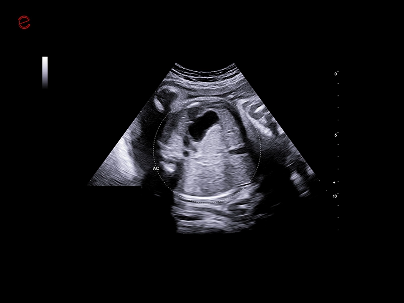 MyLab™C25 - AUTO OB