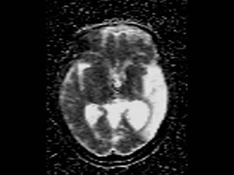 Magnifico™Open - ADC