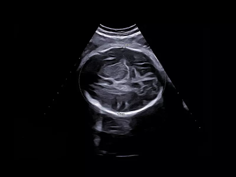 MyLab™X90 - Women's Health 04