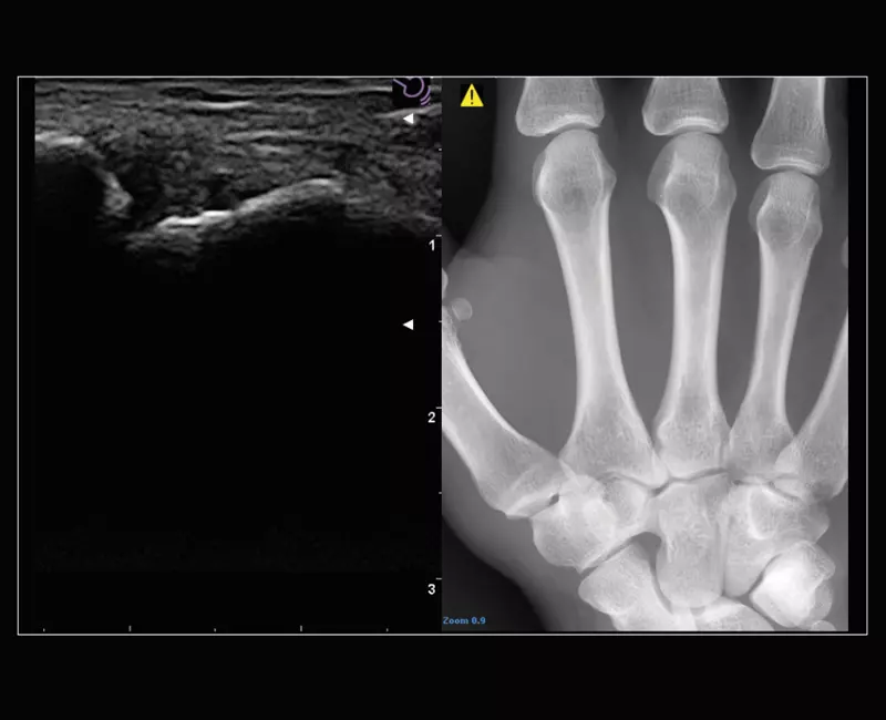 MyLab™Sigma Elite - Follow Up in real-time with a second modality