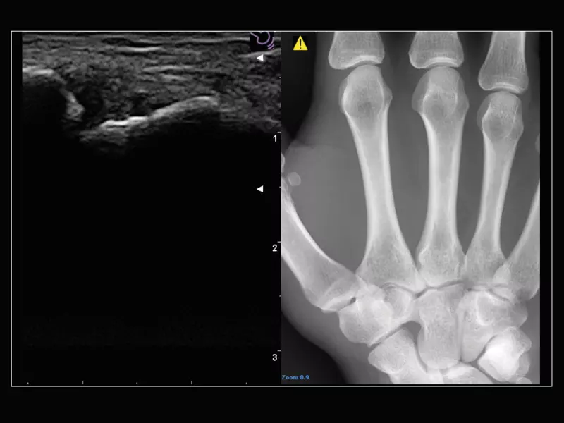 MyLab™Sigma Elite - Follow Up in real-time with a second modality