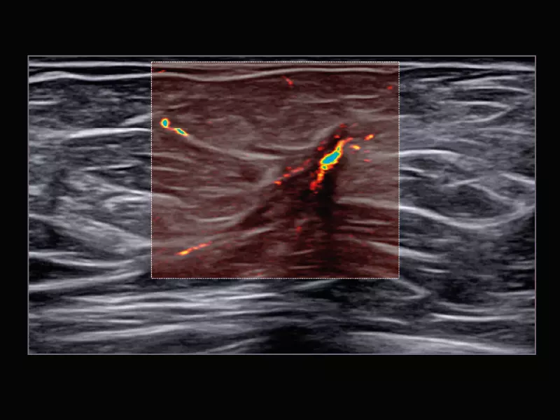 MyLab™X9 - Breast 04