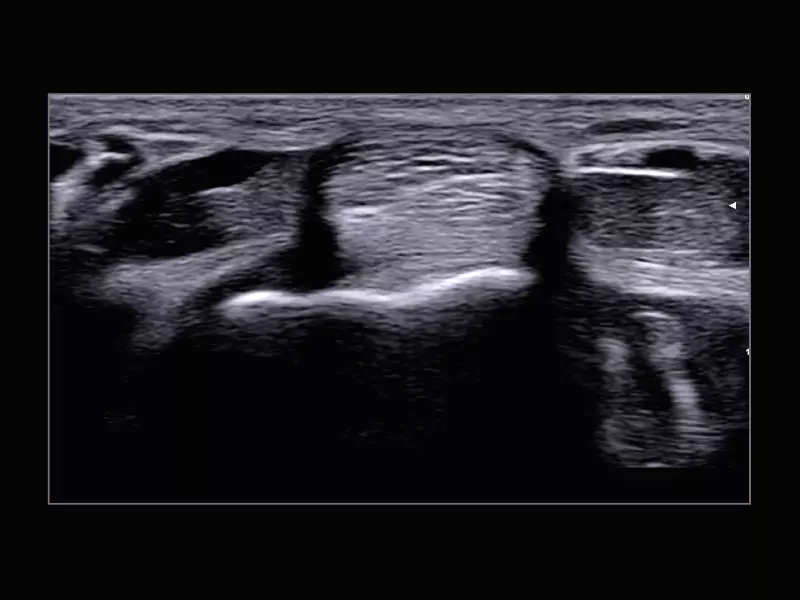 MyLab™X9 - Superficial 02