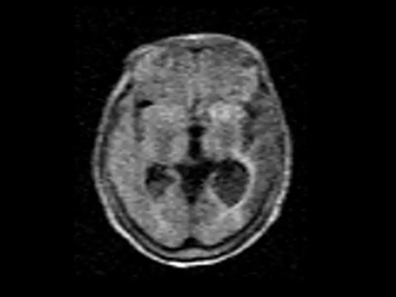 Magnifico™Open - B value 760