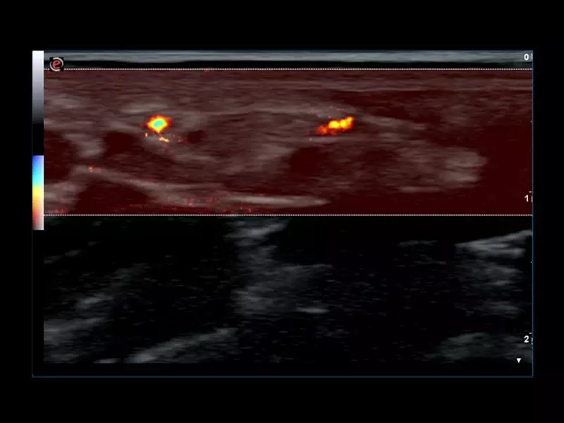 MyLab™Omega eXP -microV