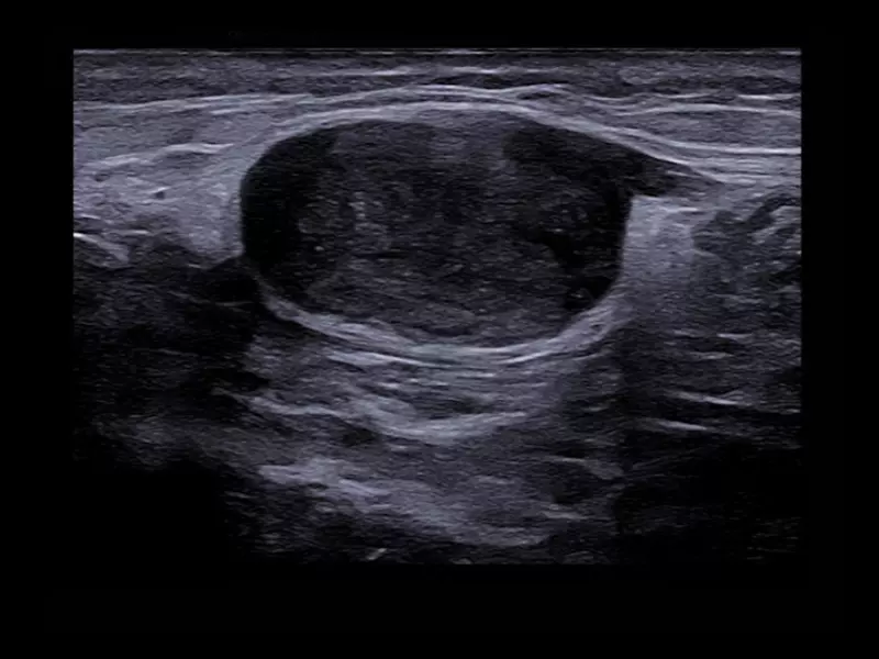 MyLab™X90 - MSK 01