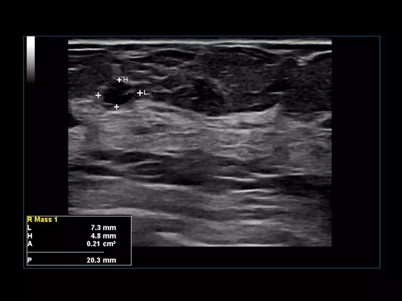 MyLab™Omega eXP - eDetect