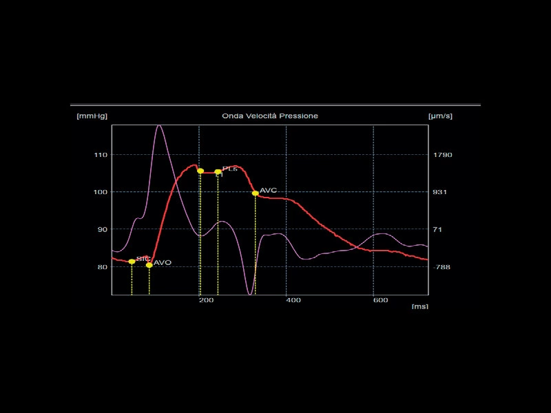 MyLab™X75 - Cardiovascular 01