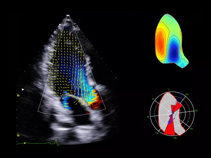 MyLab™X90 - Cardiovascular 02