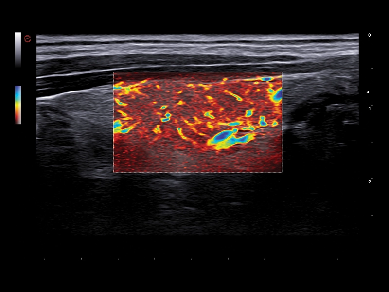 MyLab™A50 - HY microV