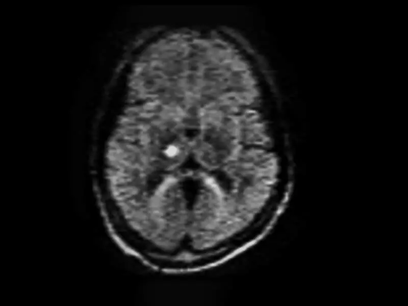 Magnifico™Open - DWI 1