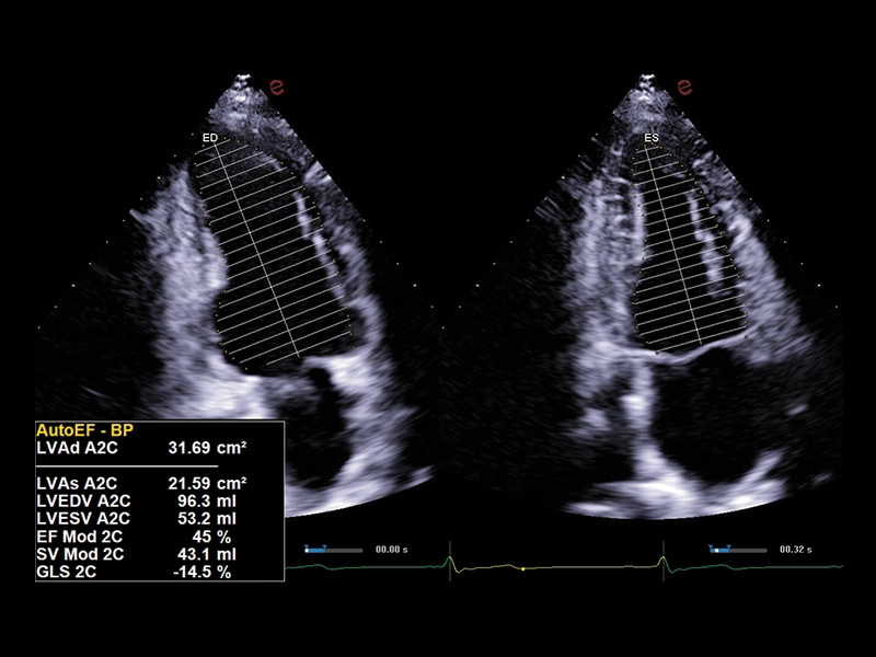 MyLab™A70 - AutoEF