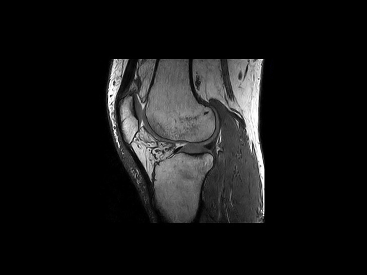 MRI experience for Sports Clinicians