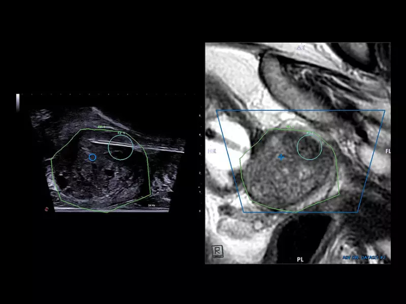 MyLab™X90 - Urology 03