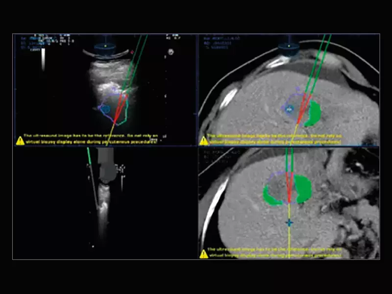 MyLab™X9 - Interventional
