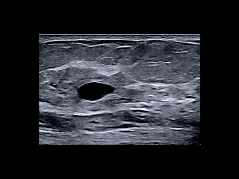 MyLab™X75 - Women's Health 04