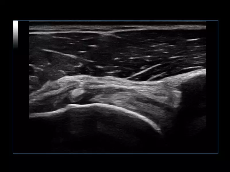 MyLab™Omega eXP - General Imaging 03