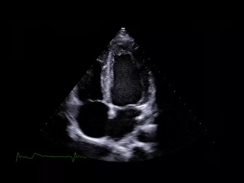 MyLab™X90 - Cardiovascular 05