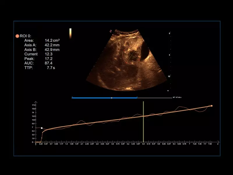 MyLab™Omega eXP - CnTI™