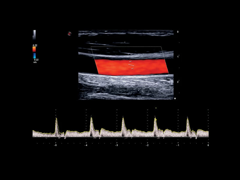 MyLab™X75 - Cardiovascular 04