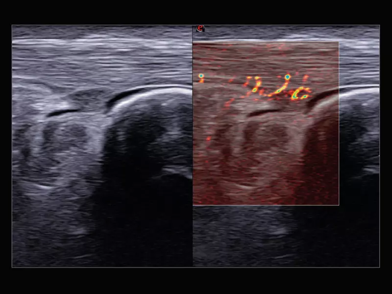 MyLab™X9 - General Imaging 04	