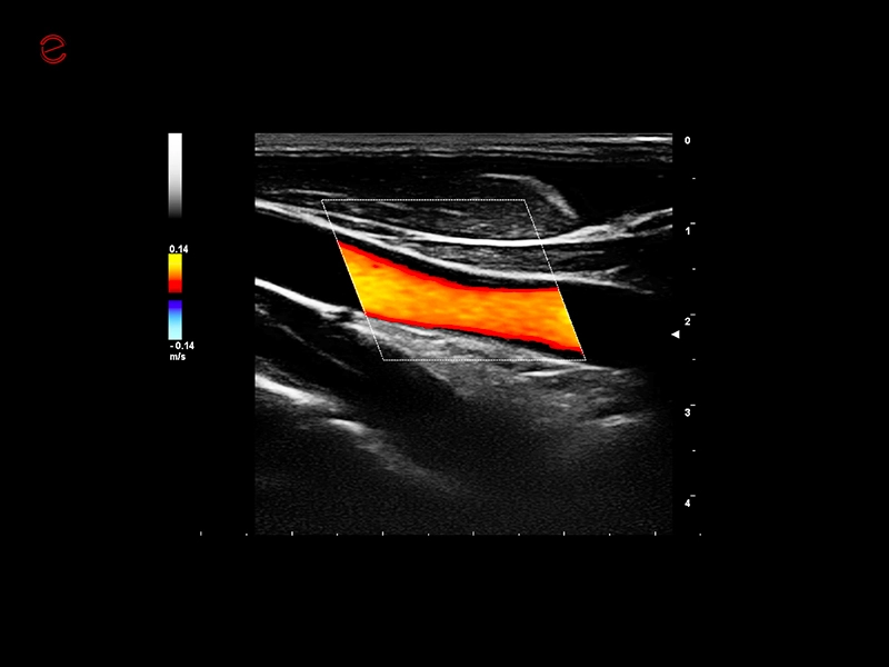 MyLab™C25 - TSA-CFM