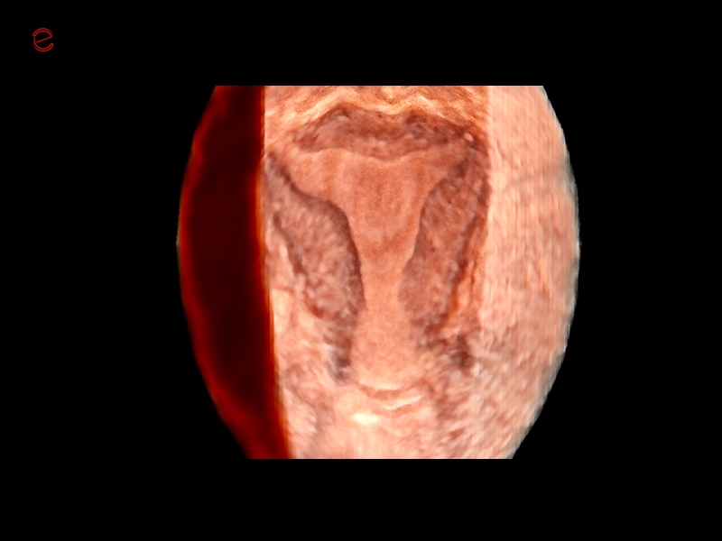MyLab™C30 - Gyn 3D