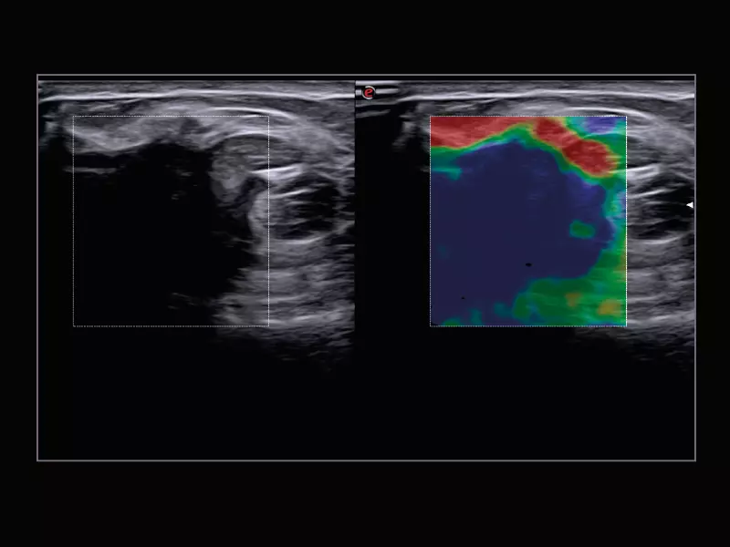 MyLab™X9 - Breast 03