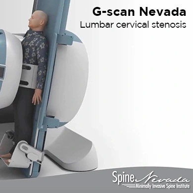 G-scan Spine Nevada revealing lumbar stenosis