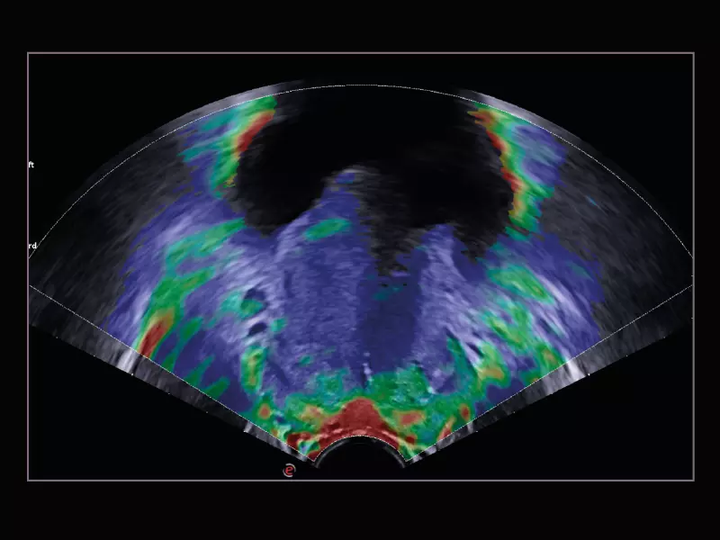 MyLab™X9 - Urology 04