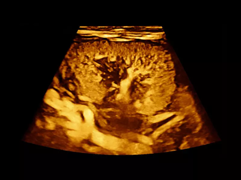 MyLab™X90 - General Imaging 04