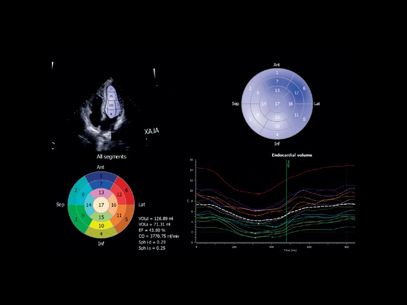MyLab™X75 - Cardiovascular 02