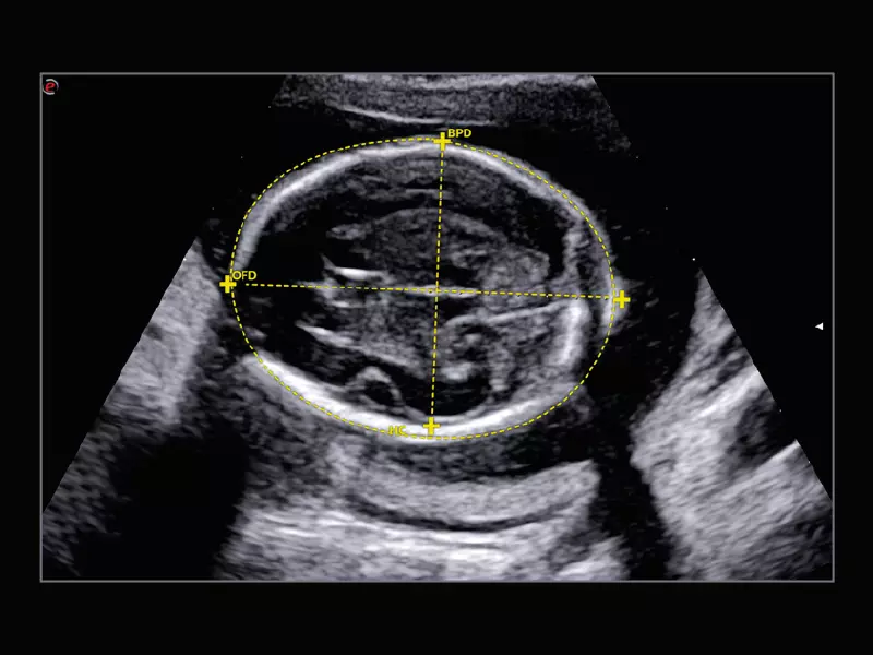 MyLab™X9 - Shared Service 04