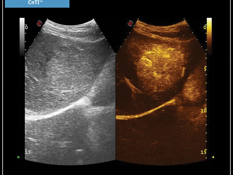 MyLab™X7 - CnTI™
