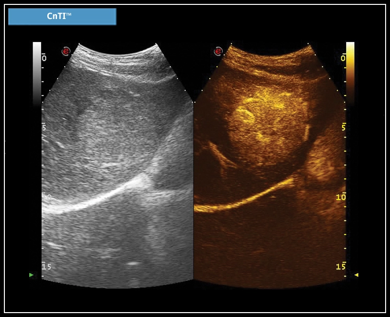 MyLab™X7 - CnTI™