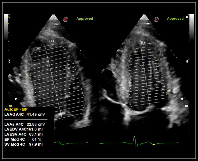 MyLab™Omega - Zero-Click AutoEF