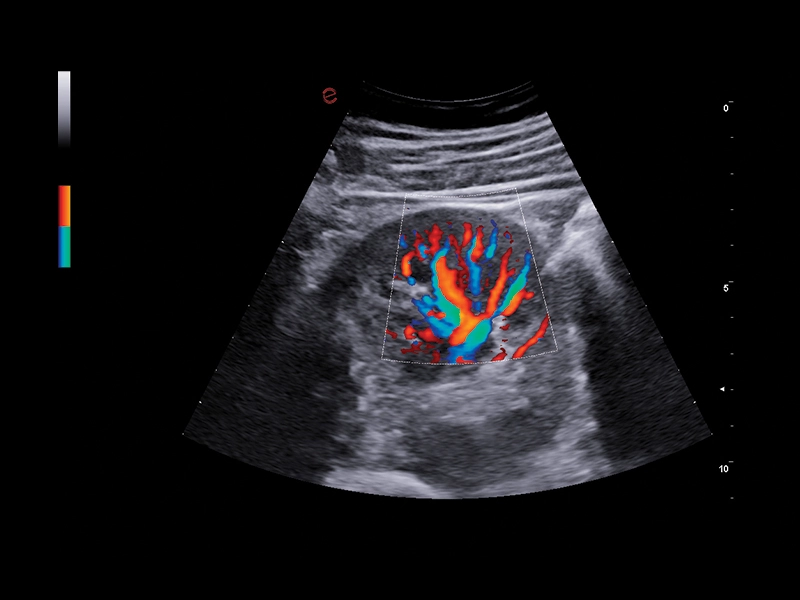 MyLab™A50 - PWD kidney
