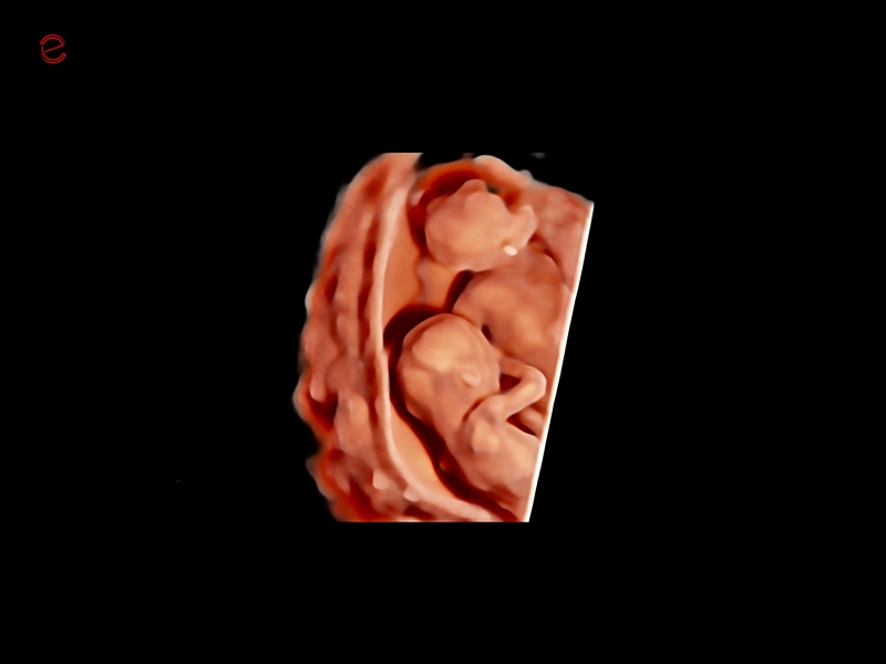 MyLab™C30 - 4D VC2