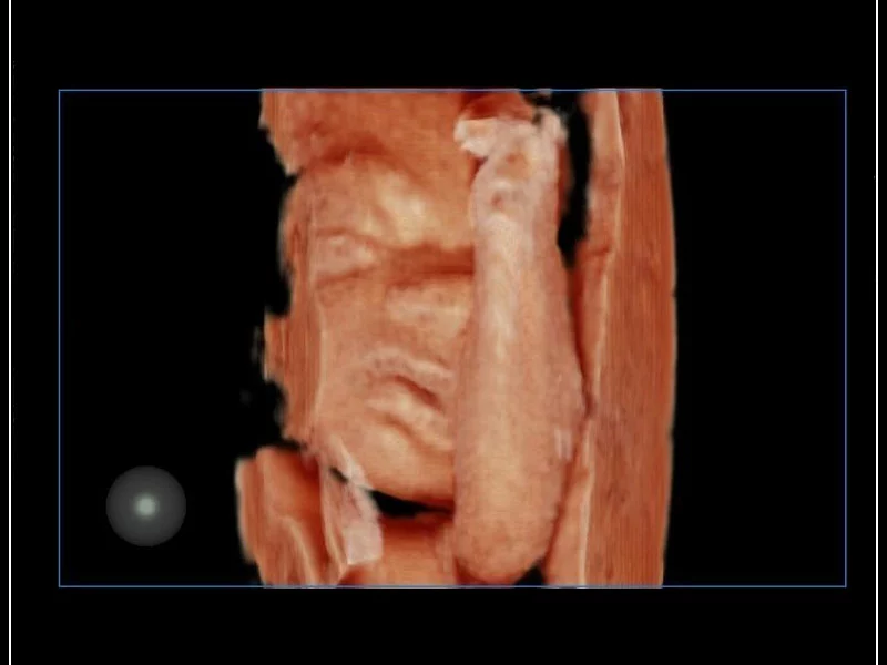 MyLab™9 Platform - Baby Face rendering in real-time with XLight