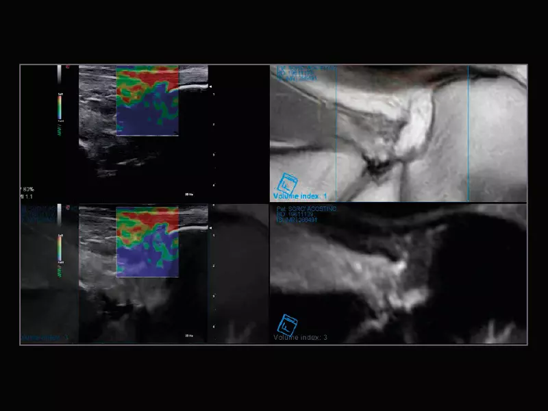 MyLab™X9 - Superficial 01