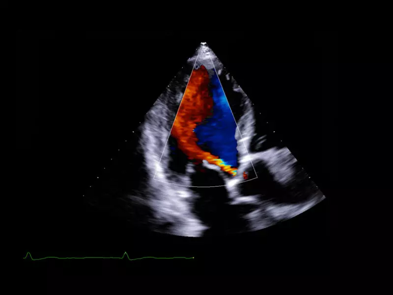 MyLab™X90 - Cardiovascular 07