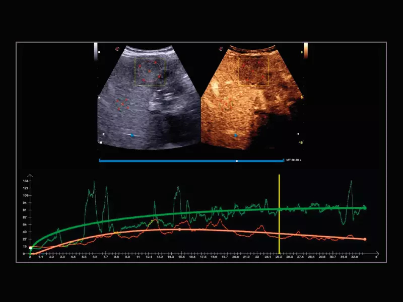 MyLab™X9 - Liver 05