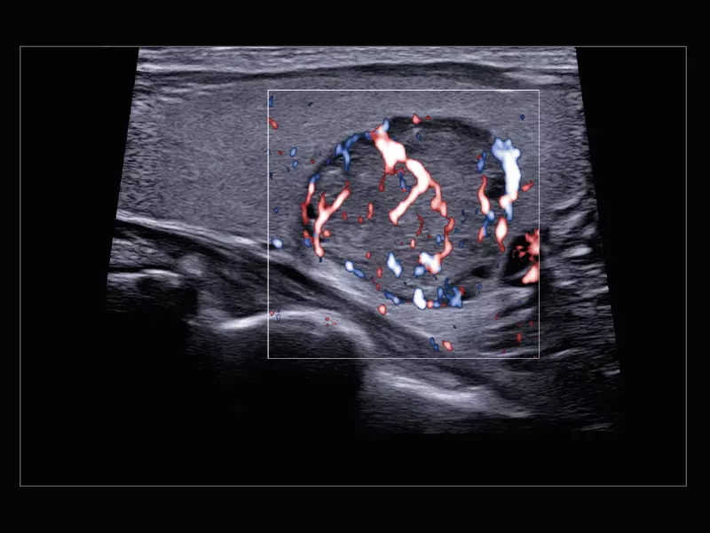 MyLab™X9 - General Imaging 03