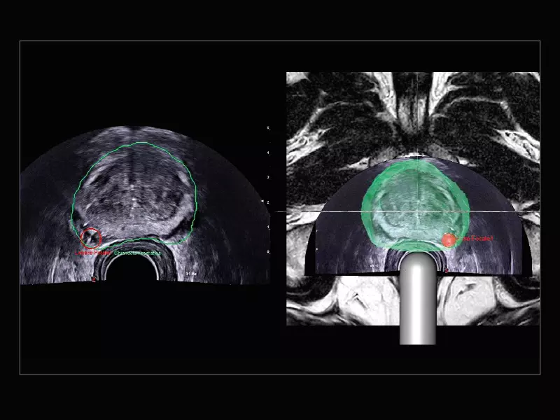 MyLab™X9 - Urology 06