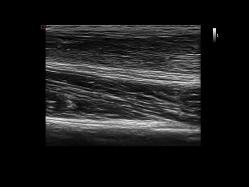 MyLab™X1 Go - General Imaging 02